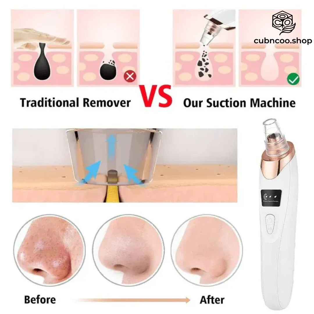5 In 1 Black Head Remover Machine